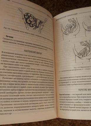 Медичний справочник "гінекологія"4 фото