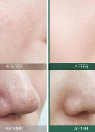 Кислотный очищающий тоник для проблемной кожи some by mi aha-bha-pha 30 days miracle toner