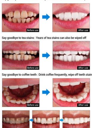 Сыворотка, эссенция, средство для отбеливания зубов и удаления зубного налета lanbena5 фото