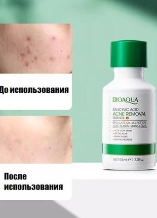 Сироватка із саліциловою кислотою від прищів і висипки2 фото
