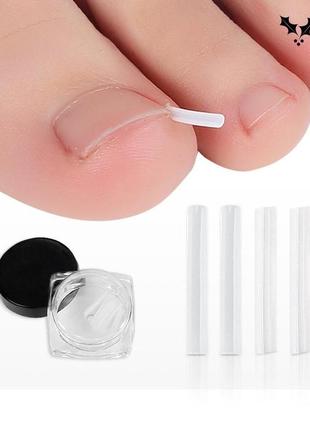 Коректор врослих нігтів, вкладки для врослих нігтів 10 шт.
