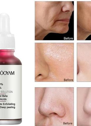 Кислотный кровавый пилинг-сыворотка для лица