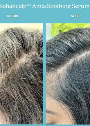 Fable &amp; mane sahascalptm amla soothing serum масло-сыворотка для чувствительной и...