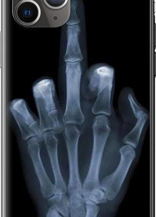 Чохол на iphone 11 pro max рука через рентген "1007u-1723-10746"