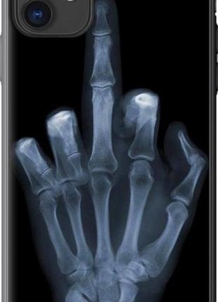 Чехол на iphone 11 рука через рентген "1007u-1722-10746"
