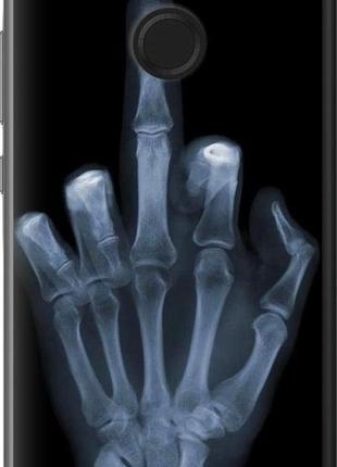 Чехол на huawei nova 2 рука через рентген "1007u-1021-10746"