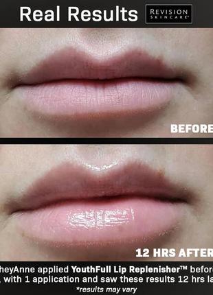 Омолаживающее средство для увеличения объема губ youthfull lip replenisher revision skincare3 фото