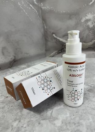 Фигурка "царевна лягушка"