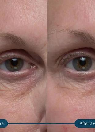 Подтягивающий, осветляющий и укрепляющий крем для глаз elemis pro-collagen vitality eye4 фото