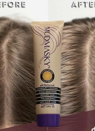 Сироватка скраб для шкіри голови mudmasky