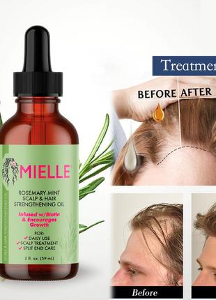 Mielle rosemary mint scalp hair oil олія для росту волосся з розмарином проти випадіння  біотин daeng aminexil масло маска бальзам