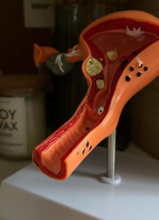 Анатомічна модель - матка