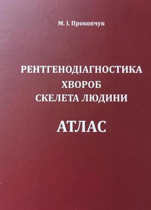 Продам атлас рентгенодіагностика хвороб скелета людини