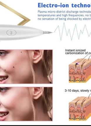 Електрокоагулятор для видалення папілом і бородавок (плазмова ручка)1 фото