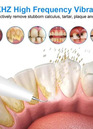 Скалер зубной peicon n-g6 ультразвуковой для удаления каменя и пятен с набором зубного инструмента white8 фото