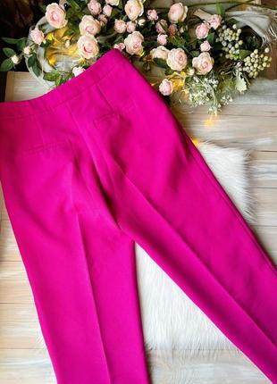 Рожеві короткі брюки7 фото