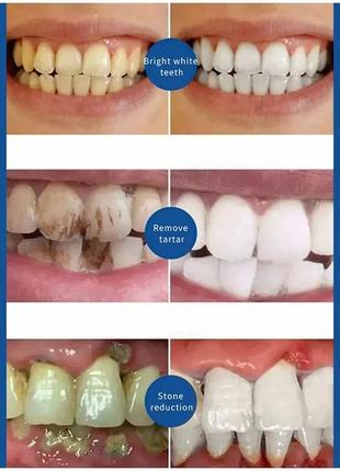 Зубна паста з ефектом зняття зубного каменю та відбілювання,2 фото