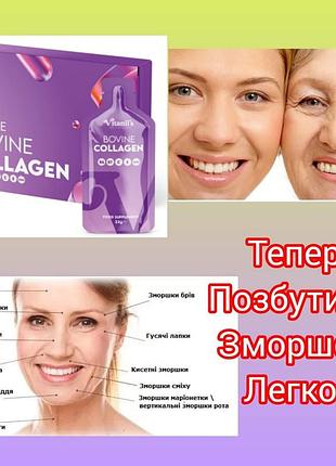 Гелева дієтична добавка "гідролізований колаген" у стіках vitanil's, 14 шт.х23 г