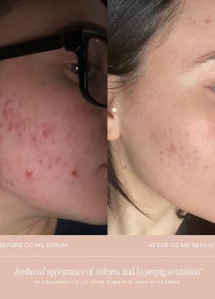 Summer fridays cc me vitamin c serum сироватка з вітаміном с