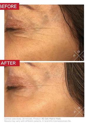 Dr. levy r3 cell matrix mask відновлююча маска проти передчасного старіння та пошкоджень шкіри
