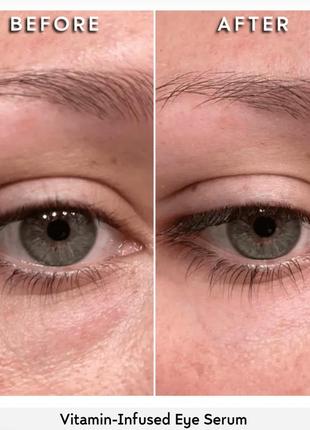 Сироватка для шкіри навколо очей mudmasky vitamin-infused eye serum 30мл2 фото