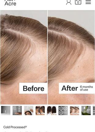 Серум для кожи головы