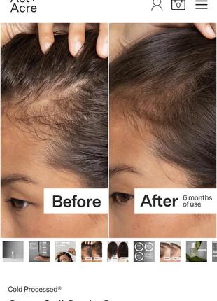 Серум для кожи головы