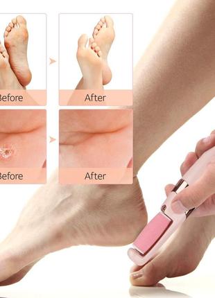 Пилка для пяток flawless pedicure tool шлифовальная пилка для ног, электрическая пемза для ног (st)