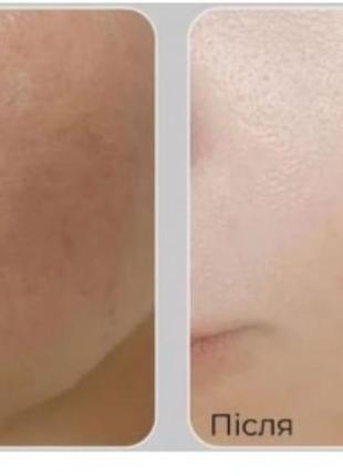 Крем для лица с пептидами и комплексом витанола medi-peel peptide 9 vitanol cream pro 50ml4 фото