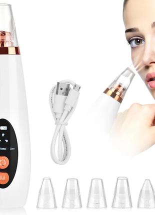 Вакуумний апарат для чищення пор обличчя multi-functional blackhead remover4 фото