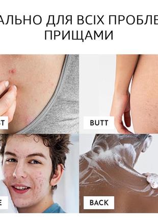 Мило від вугрів / прищів для обличчя та тіла truly clear one step acne bar5 фото