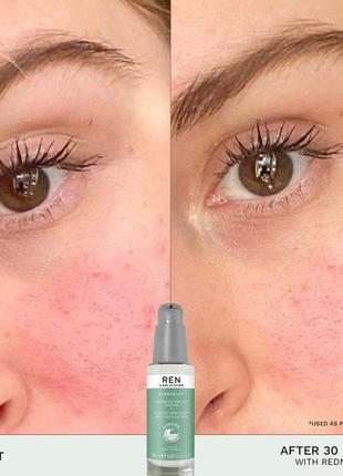 Сыворотка для кожи лица снятия покраснений чувствительной кожи ren evercalm redness relief serum2 фото