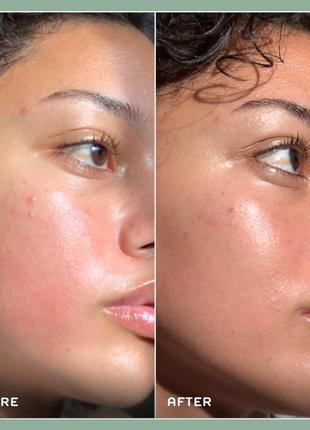 Сыворотка для кожи лица снятия покраснений чувствительной кожи ren evercalm redness relief serum3 фото