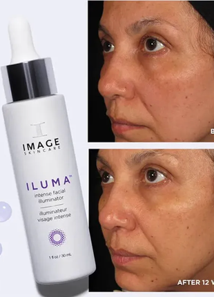 Image skincare iluma intense facial illuminator ілюмінайзер1 фото