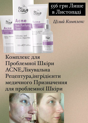Набір acne для проблемної шкіри