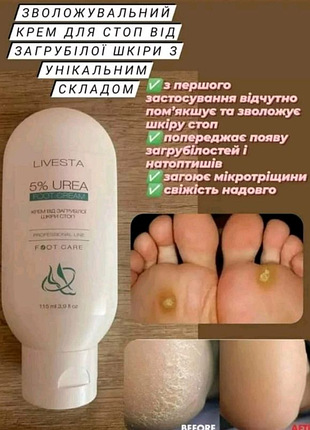 Зволожувальний крем для стоп від загрубілої шкіри livesta, 115 мл