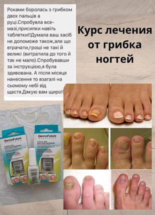 Лак терапія