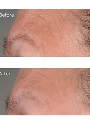 Лифтинг сыворотка для укрепления упругости кожи perricone md