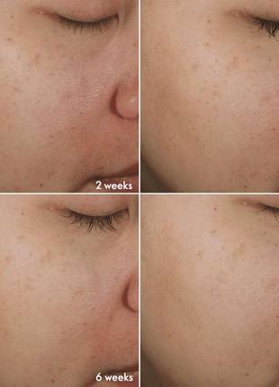 Комплексный уход против пигментации bright intense2 фото