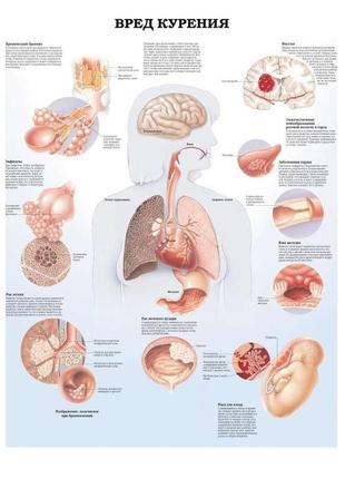 Плакат а3. вред курения