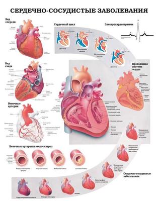 Плакат а3. серцево-судинні захворювання