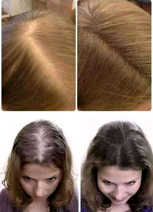 Комплекс проти випадіння волосся3 фото
