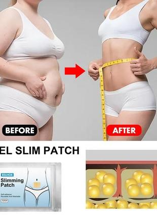 Пластири для схуднення slimming patch8 фото