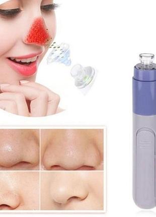 Face spot cleaner ручної на батарейках вакуумний очищувач пір до