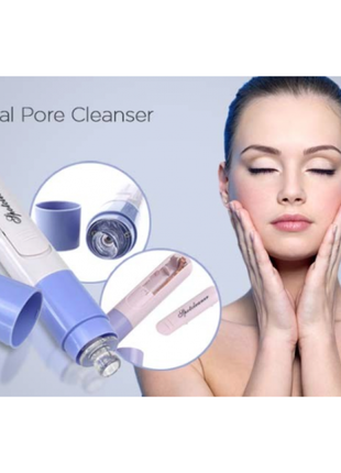 Elite pore cleaner вакуумний ручний апарат для чищення пір особи,