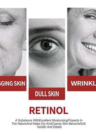 Крем для обличчя ouhoe retinol 30г. крем від зморшок ouhoe retino8 фото