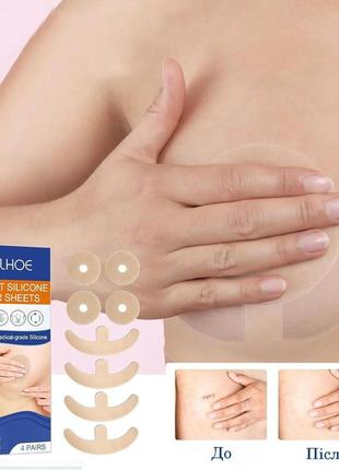 Силіконовий пластир для грудей від рубців breast silicone scar sheets