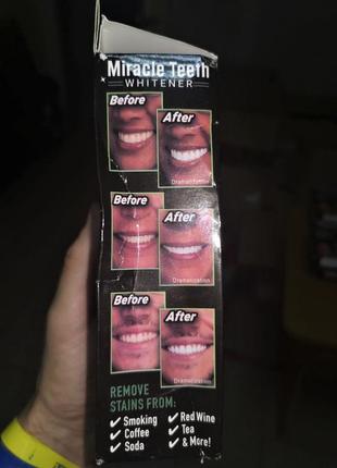 Засіб для відбілювання зубів miracle teeth whitener4 фото