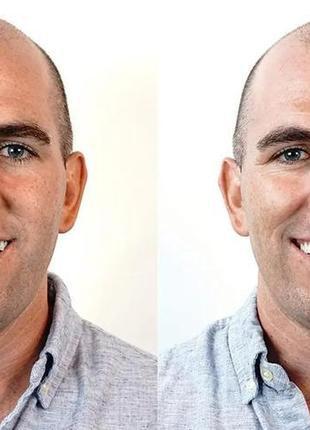 Набір для тимчасових зубів instant smile triple shade заміна 5 хв3 фото