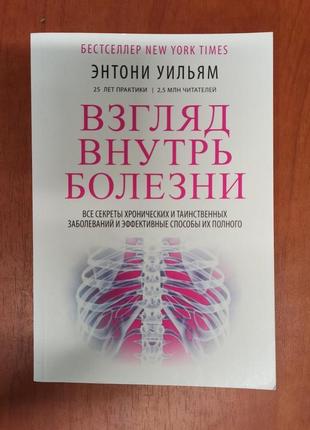 Ентоні вільям. погляд усередині хвороби. всі секрети хронічних...